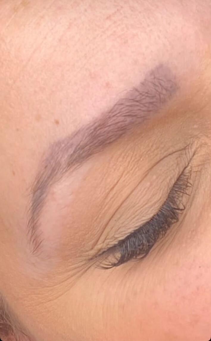 Pigment estompé — réalisation de détatouage par Le Pouvoir De Soi