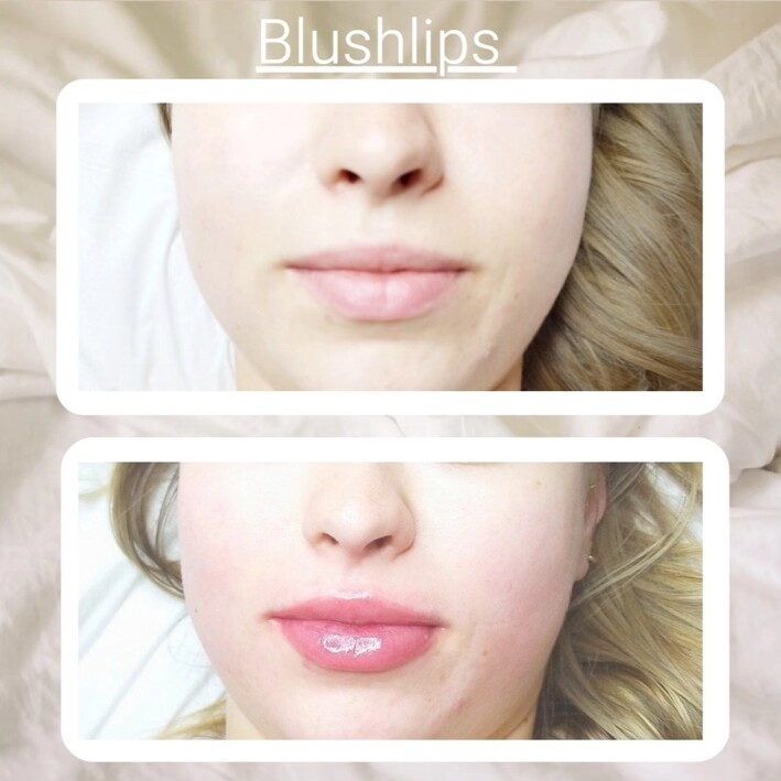 Rose délicat — pigmentation des lèvres par Le Pouvoir De Soi