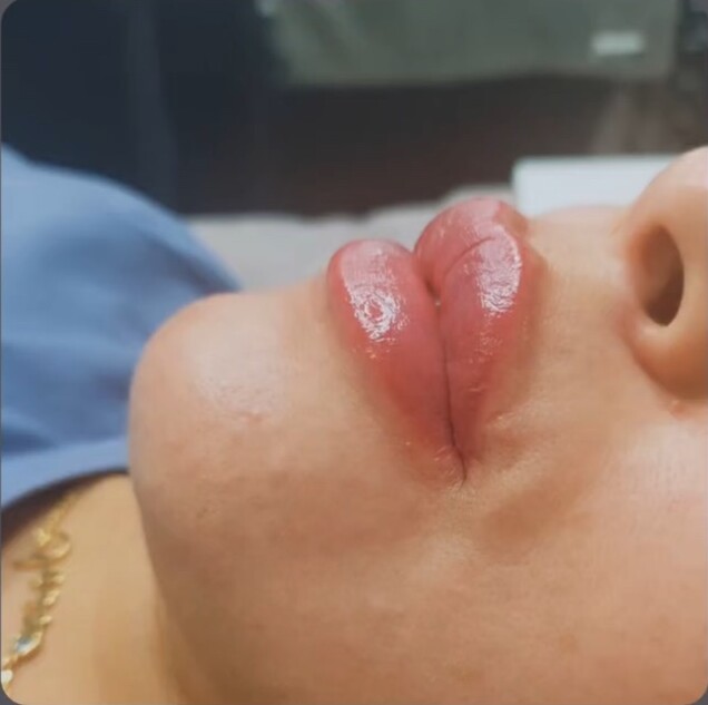 Fini lumineux — pigmentation des lèvres par Le Pouvoir De Soi